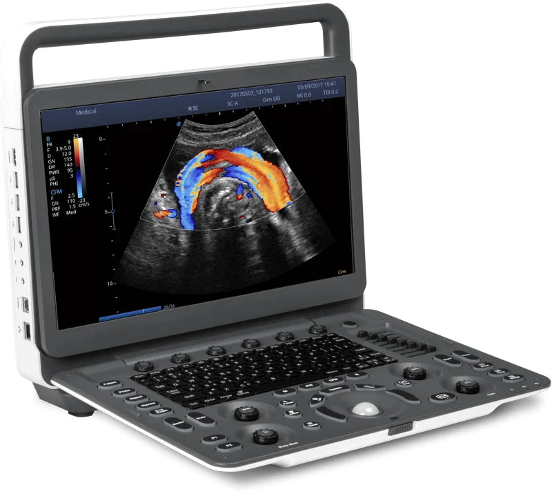 Unveiling the Sonoscape E2 - Pro Ultrasound: A Comprehensive Review