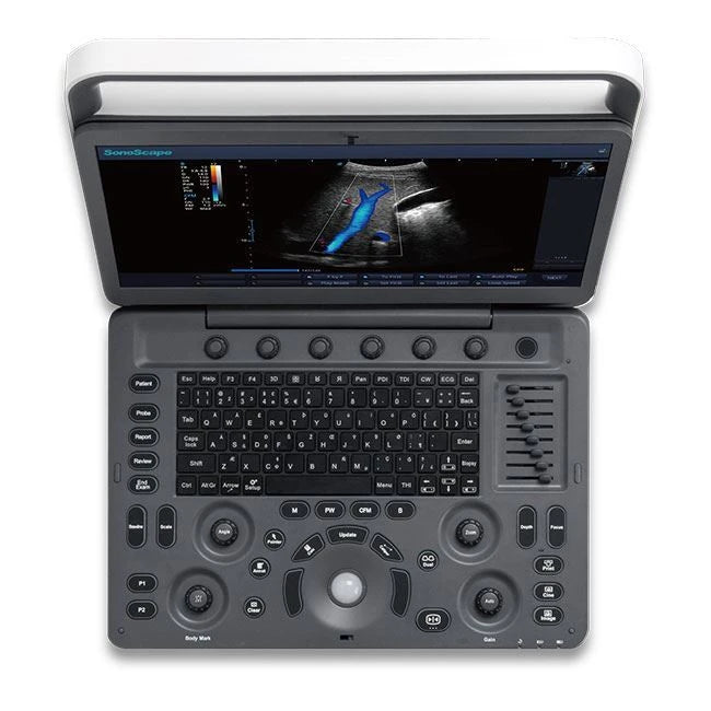 Sonoscape E2 - Pro Ultrasound